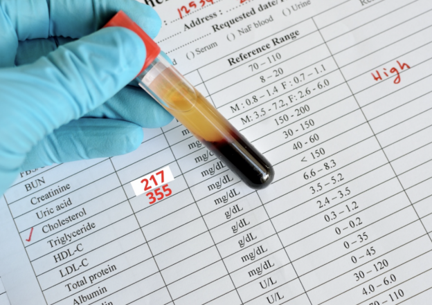 Diabetes And Dyslipidemia Are All Both Treatable Once You Decide On It
