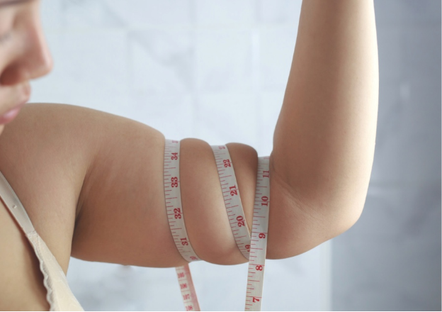 Undiagnosed Insulin Resistance Was The Root Cause Of Weight Gain Skin Discolouration